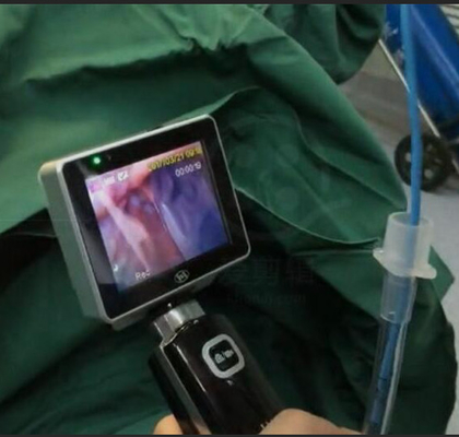 Laringoscopio di intubazione monouso di ICU SME video con una risoluzione di 1280 x 720 macchine fotografiche