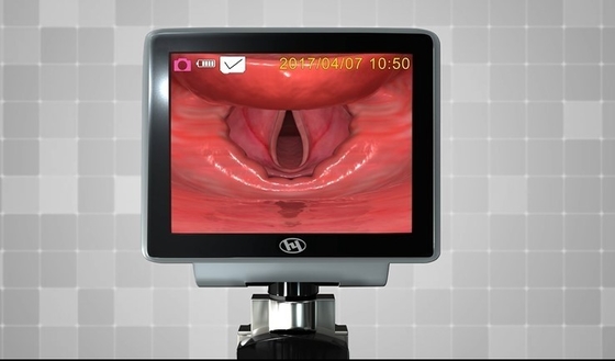 Laringoscopio a fibra ottica di plastica 1320 del metallo di HYHJ video con le lame eliminabili