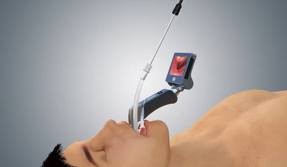 Laringoscopio di 5 Mac Miller Blades Medical Digital Video con lo stinco ergonomico della mano