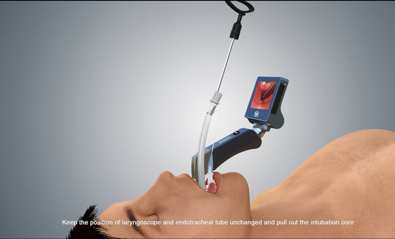 Video laringoscopio USB portatile HD Pediatrico per adulti Haiye Medical