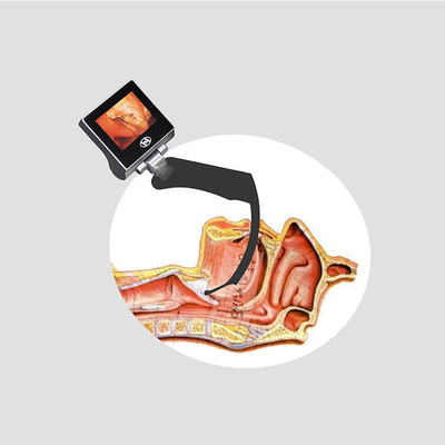 Video laringoscopio rigido medico LCD a 360 gradi con batteria ricaricabile
