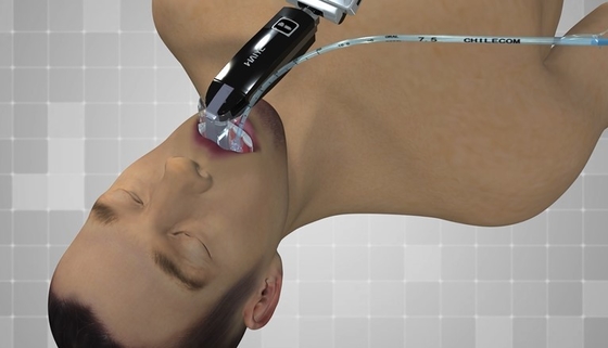 Il Usb ottico del laringoscopio dello schermo dell'endoscopio elettronico otorinolaringoiatrico a 3,0 pollici dell'ospedale ha prodotto