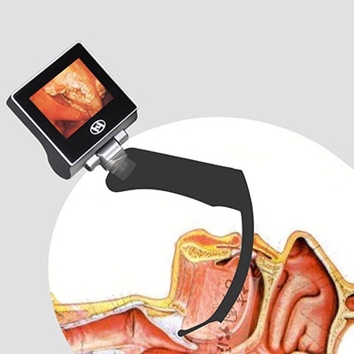 Laringoscopio di anestesia riutilizzabile LCD di 360 gradi video 2 milione pixel