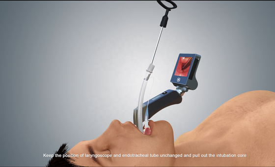 laringoscopio chirurgico di 100mm Endoscopevideo con le lame riutilizzabili