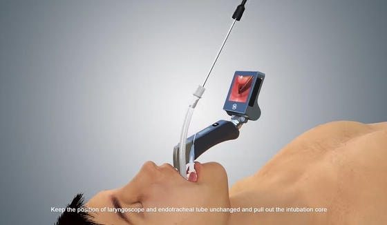 Laringoscopio di Digital del metallo del Medico-grado di HYHJ-KC video dell'anti della nebbia sistema materiale della macchina fotografica