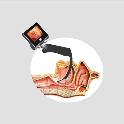 laringoscopio portatile USB di 1280*720px Haiye il video ha prodotto