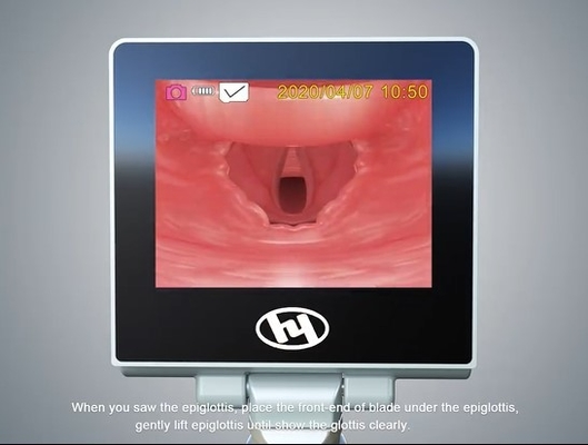 3,0 laringoscopio riutilizzabile dell'esposizione video 32 GB di attrezzatura medica